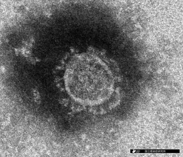 전자현미경으로 관측한 코로나바이러스
