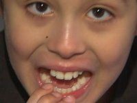 자폐 증상이 있는 크리스는 학교에서 엉뚱한 이빨이 뽑혔다